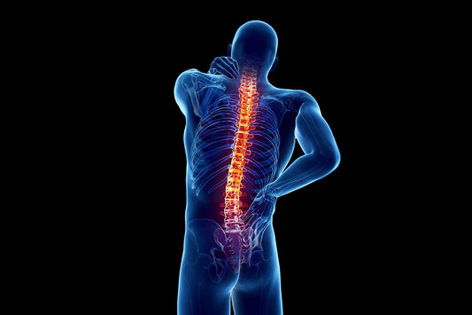 OSTEOARTROSI DELLA COLONNA VERTEBRALE.