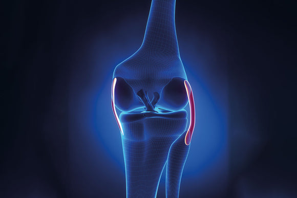 Distorsione di ginocchio senza rottura dei legamenti