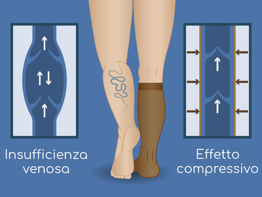 Come funziona la Compressione Elastica?