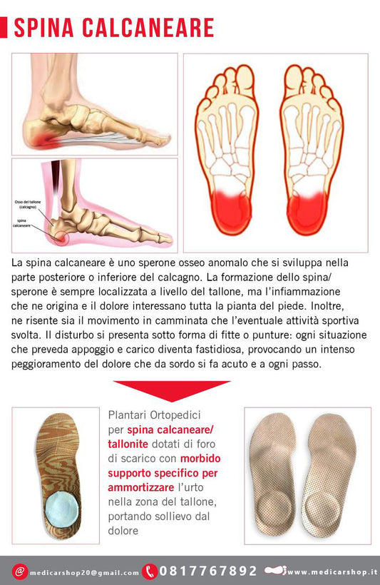 Spina calcaneare
