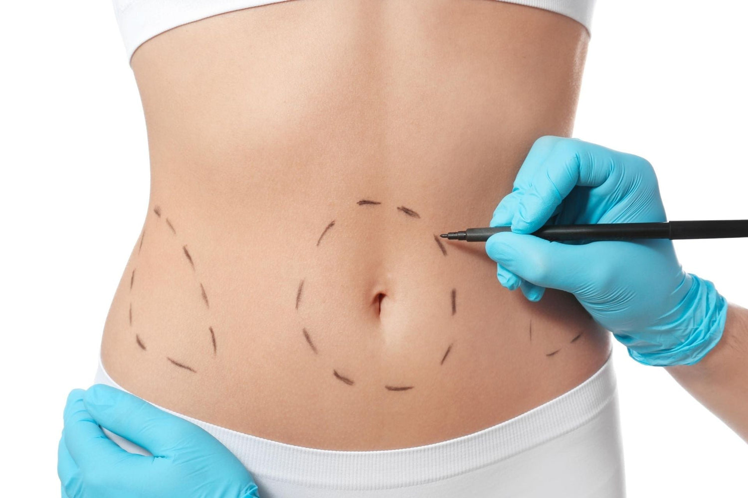 Chirurgia Estetica & Decorso Post-Operatorio