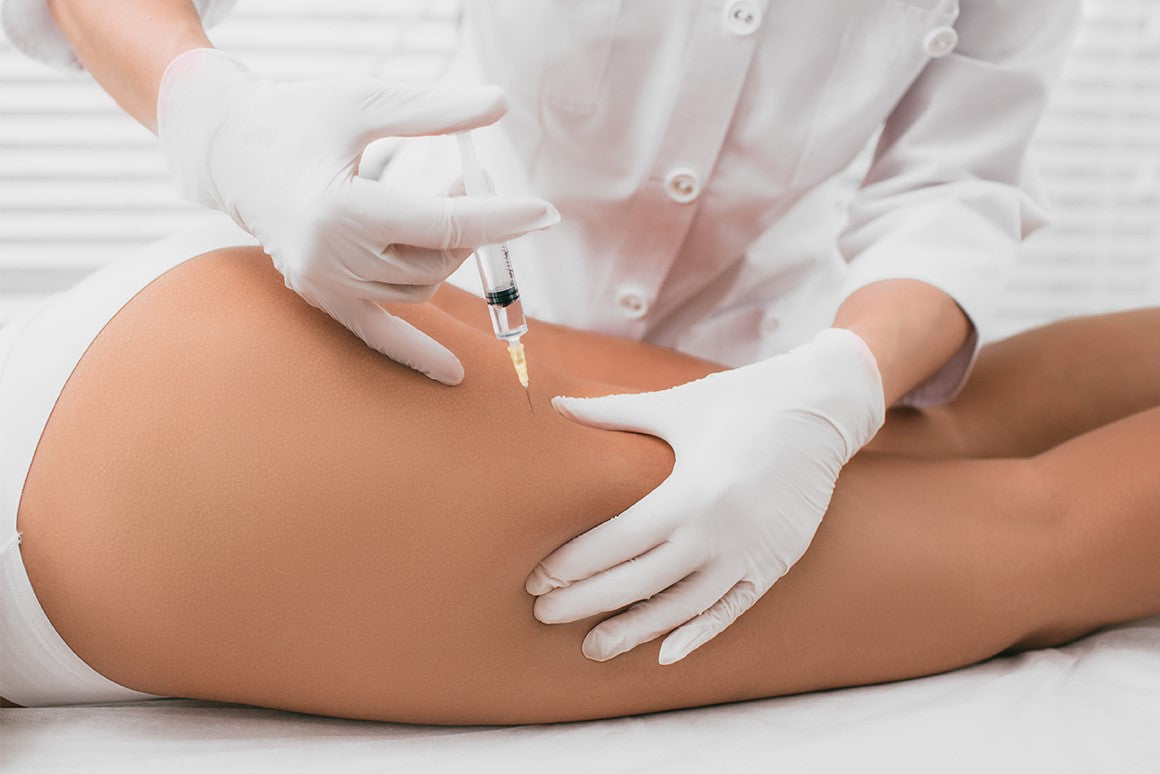Mesoterapia