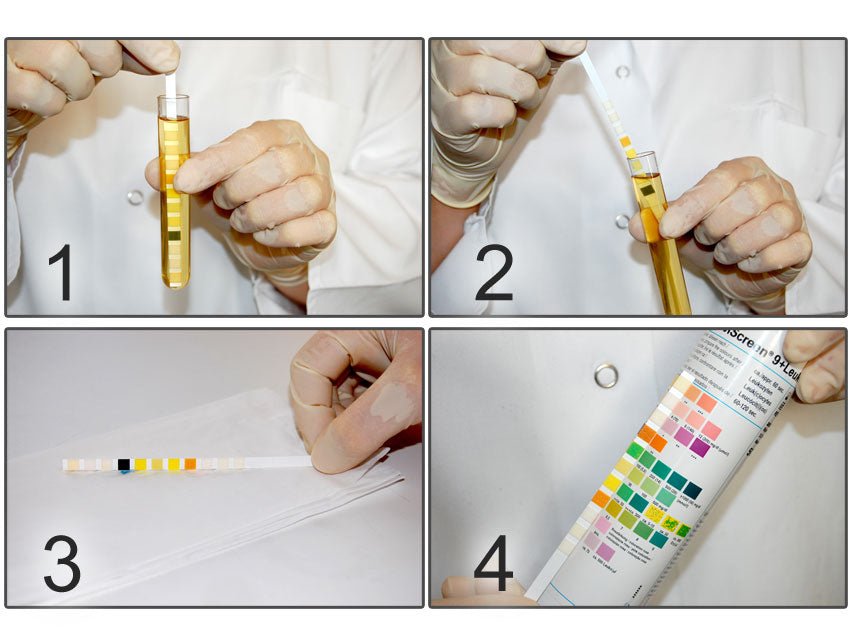 STRISCE URINE - COMBI SCREEN 11PLUS - 11 parametri