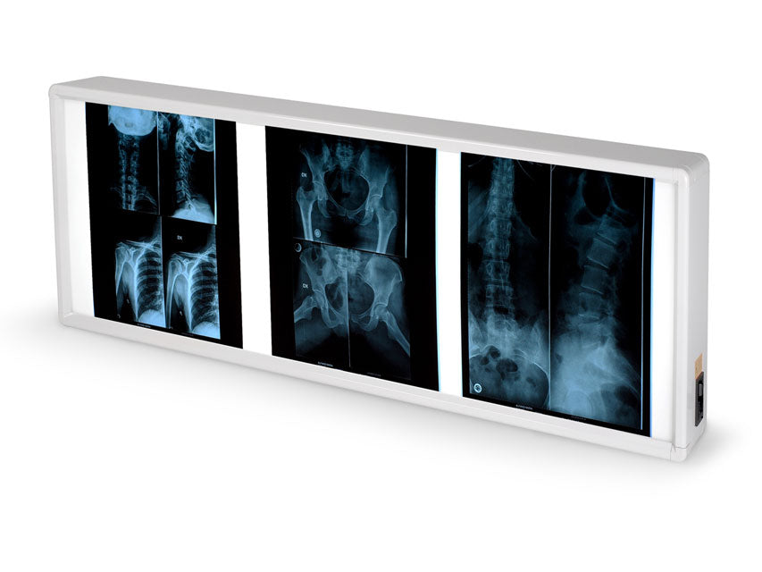 NEGATIVOSCOPIO DOPPIO 38 x 92 cm