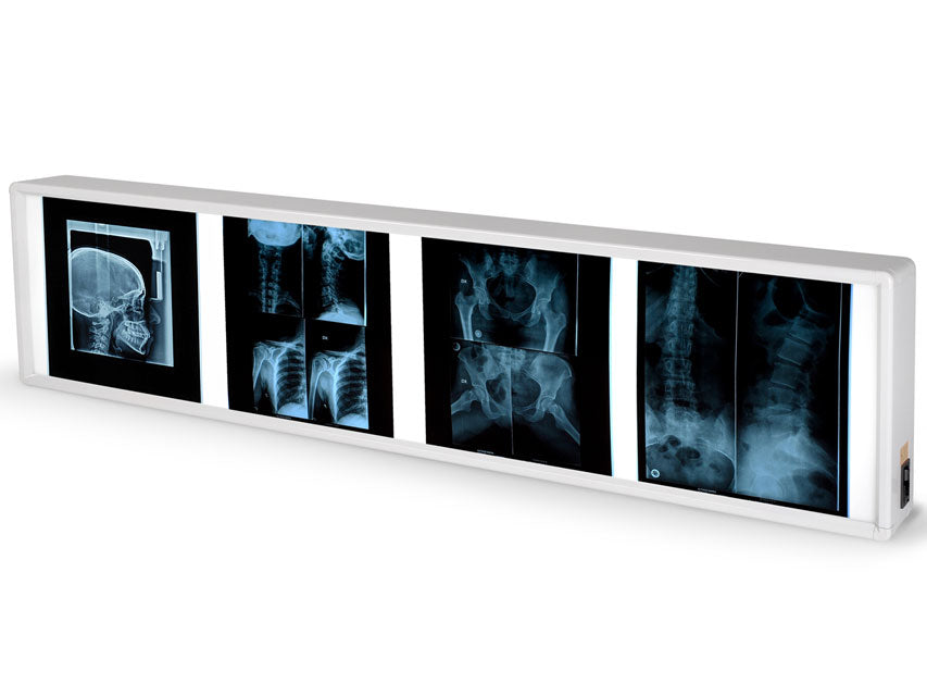 NEGATIVOSCOPIO QUADRUPLO 38 x 153 cm