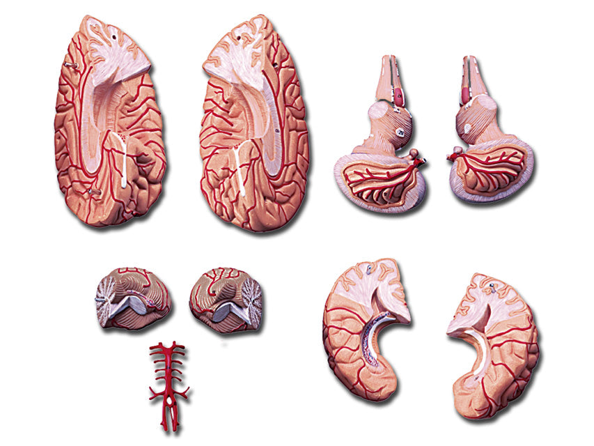 MODELLO CERVELLO CON ARTERIE - 9 parti
